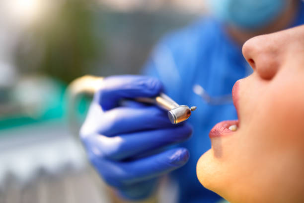 Best Wisdom Tooth Removal  in Summerfield, MD